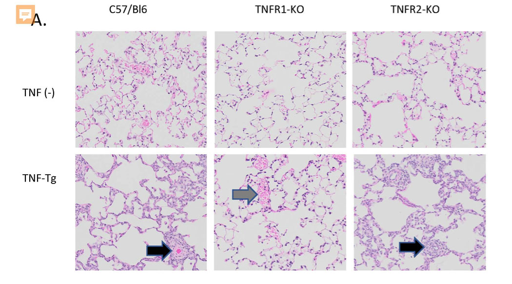 Pathogenetic Role of TNF-a and TNF receptors in Experimental Scleroderma Associated Arterial Hypertension