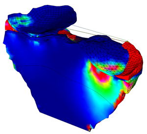 Finite element model of proximal tibia