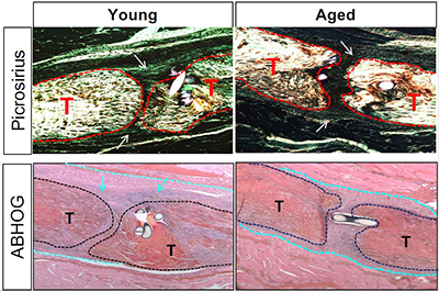 Aged Healing: Picrosirius and ABHOG from young to aged