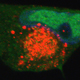 Viral Vectors For Gene Therapy And Cancer Cell Killing