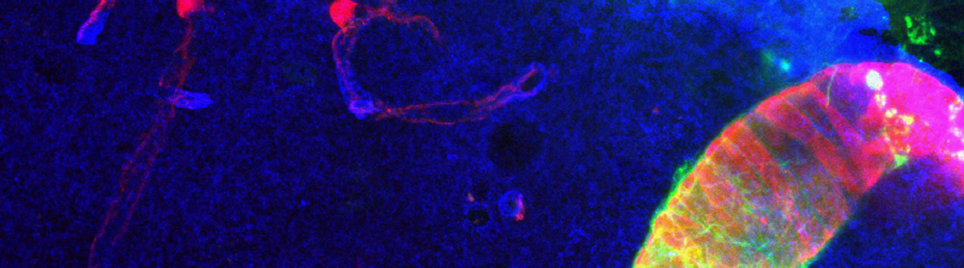 Nedergaard Research - Stained cells 2