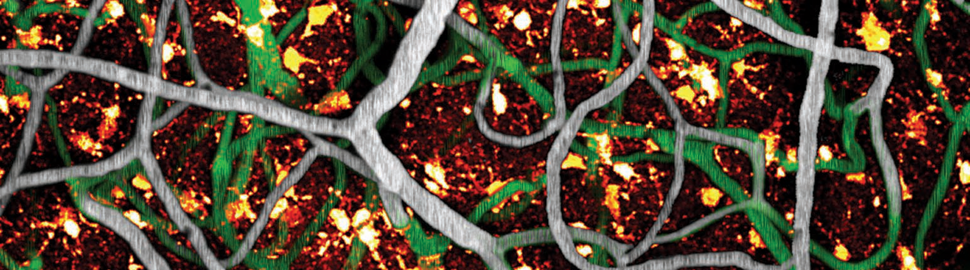 Nedergaard Research - Stained cells 7