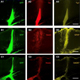 Induced-Pluripotent Stem Cell approaches to model disease