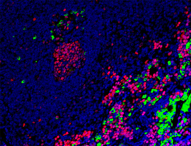 Spleen of mice treated with SINE drugs (PCNA in red and IgG in green)