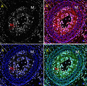 mouse carotid disease cells