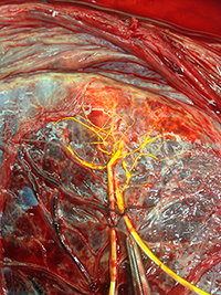 Implantation Biology