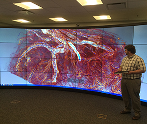 placenta on screen