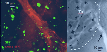 neo-vascularization