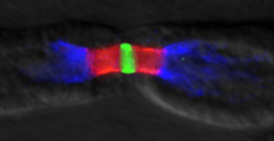 A node of Ranvier from an axon in the sciatic nerve