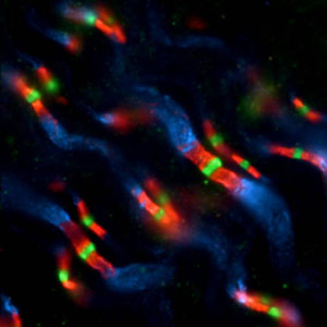 Flourescent Image of Optic Nerve