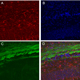 Xenobiotic Disruption of the Perinatal Testosterone Surge and Neurobehavioral Development