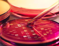 Petri dish containing gel staining