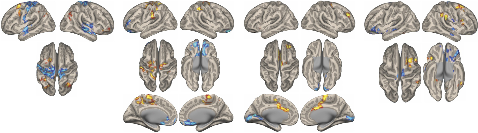 Brain scans