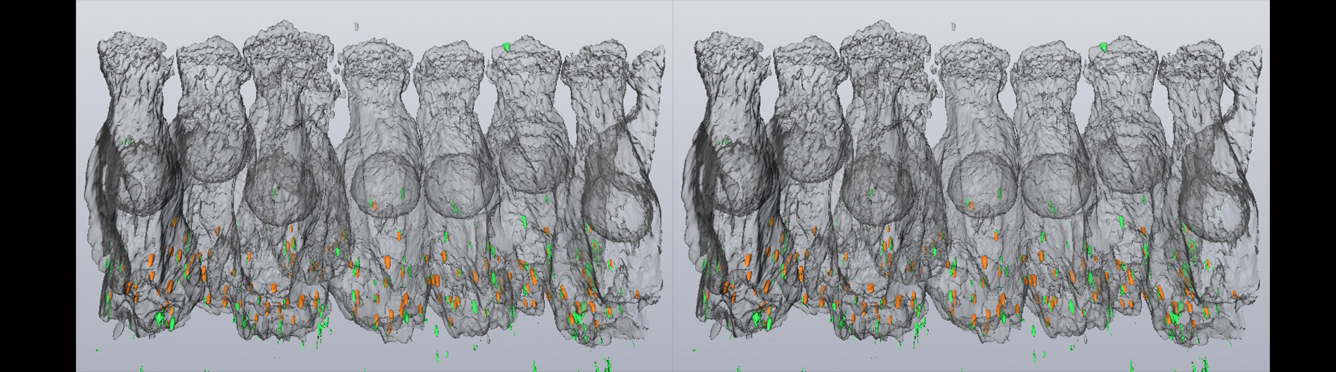 Hair Cell Reconstruction