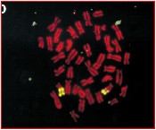 Aneuploidy image