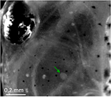 Tadpole image
