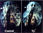 Thymus image