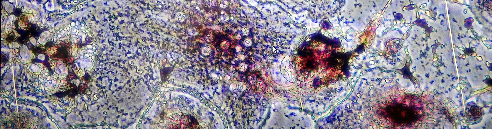 AIR research on effect of DC-STAMP on osteoporosis