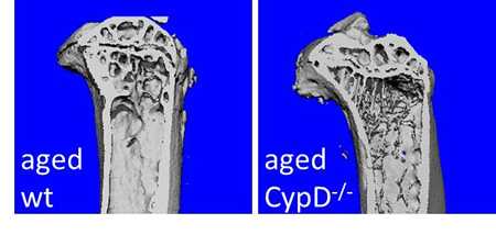 MSC Metabolism and Osteogenic Potential