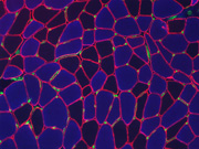 Immunoflourescence photo of myosin heavy chain slow, caveolin, and ulex.