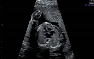 Echocardiogram image