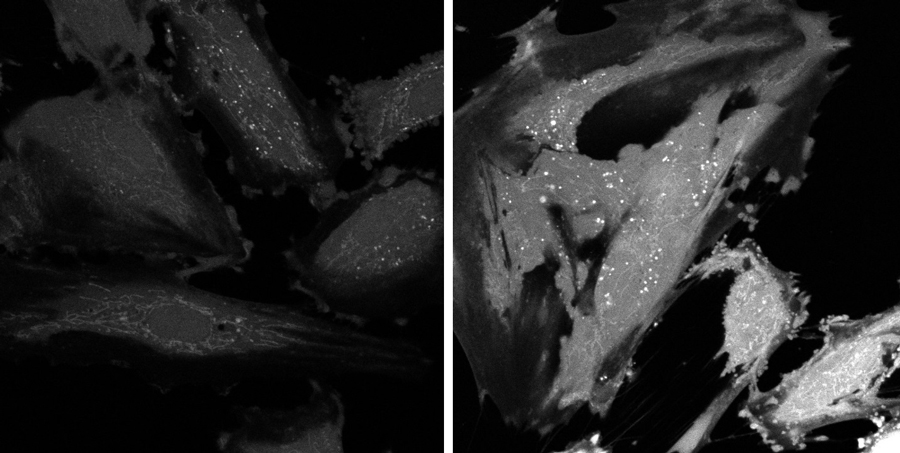 endothelial cells