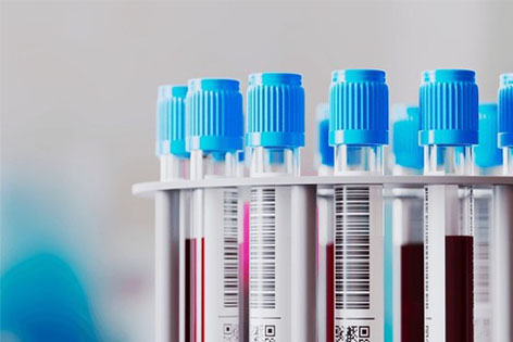 Test tubes with blood samples