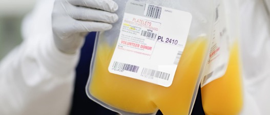 Medical bag of platelet transfusion