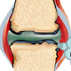 Bone Cell Regulation in Chronic Inflammatory Diseases