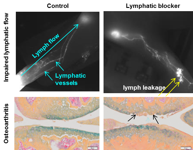 Lymphatic system