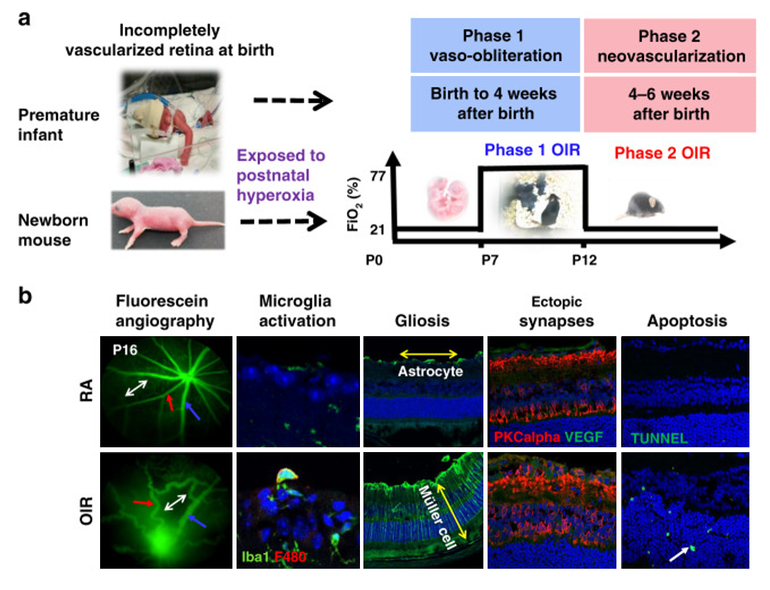 Schematic of in vivo and histologic phenotypes in ROP and OIR