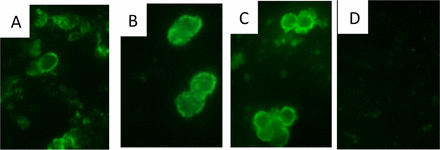 Pneumatocystis cysts