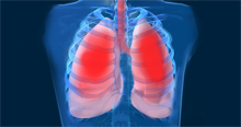 Pulmonology