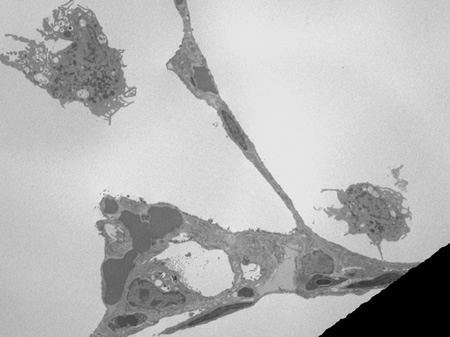 Note the gold nanoparticles attached to lysosomes in this macrophage