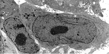 "Pop-Off" technique for EM examination of cultured cells