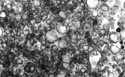 Electron micrograph of smooth endoplasmic reticulum