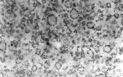 Electron micrograph of rough endoplasmic reticulum