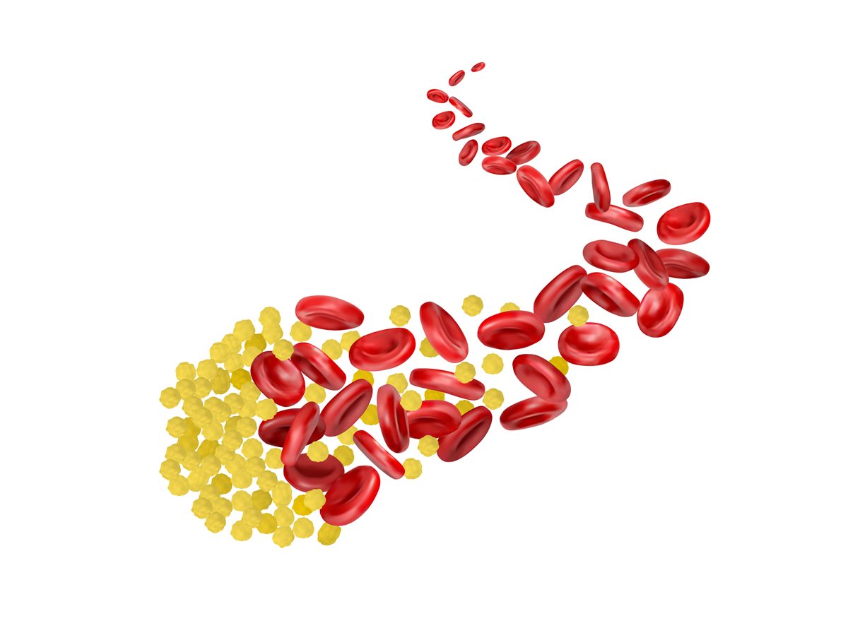 My doctor always cautions me about my cholesterol, but triglycerides are on the list in my medical record. Can you explain what they do?