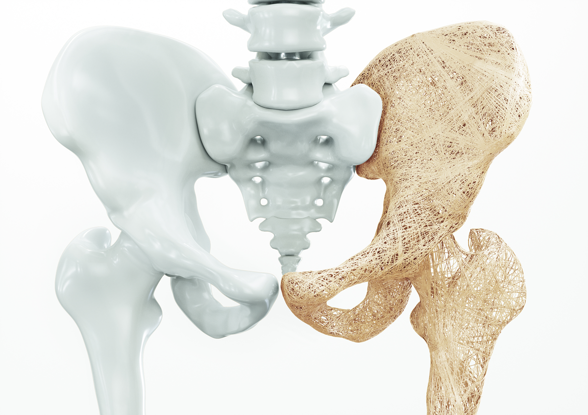 I am 55 years old. My doctor tells me I have osteopenia. But I am also shrinking in height and now have pain in my buttocks and legs. Are these changes due to menopause or just my age? 