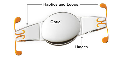 Crystalens diagram