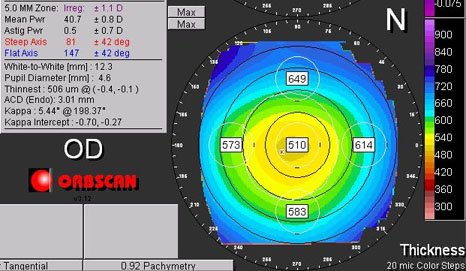 Orbscan