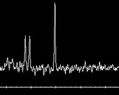 MR Spectroscopy