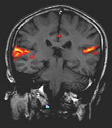 Functional MRI